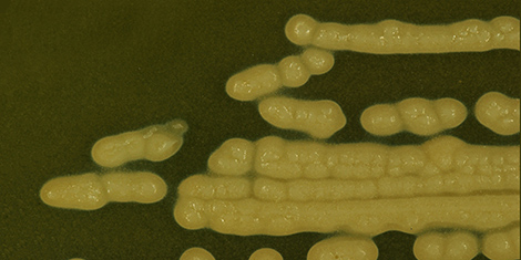 Agarplatte mit Kolonien von Clostridium botulinum. Die sporenbildenden Bakterien produzieren unter anaeroben Bedingungen Neurotoxine. Das Krankheitsbild heißt Botulismus. Quelle: © Dr. Martin Dorner/RKI