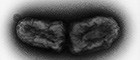 Bildausschnitt: Brucella melitensis biovar abortus (Brucellen). Transmissions-Elektronenmikroskopie, Negativkontrastierung. Vergrößerung 40000–fach. Quelle: © RKI