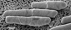 Bildausschnitt: Clostridium difficile NCTC 13307; Elektronenmikroskopie; Bakterien; Bacteria; Firmicutes; Clostridia; Clostridiales; Clostridiaceae, Primärvergrößerung x 112370. Maßstab = 500 nm. Quelle: © Norbert Bannert; Lars Möller/RKI