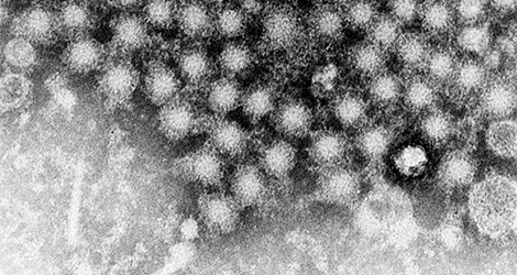 Hepatitis A-Virus. Elektronenmikroskopie. Quelle: © CDC/PHIL