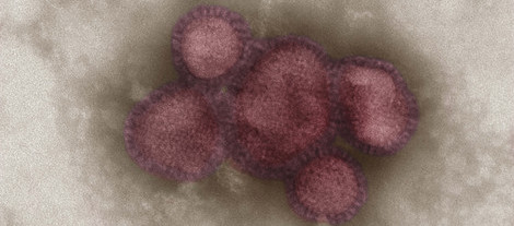 Influenzaviren vom Subtyp A/H1N1, elektronenmikroskopische Aufnahme, koloriert. Quelle: © RKI