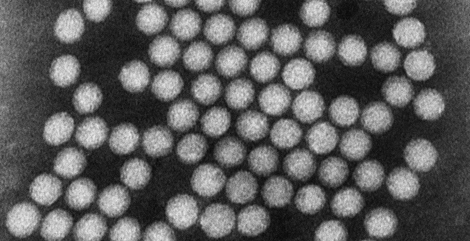 Polioviren. Ausschnitt aus einer elektronenmikroskopischen Aufnahme. Quelle: © Hans R. Gelderblom/RKI