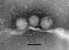 Rift Valley fever virus MP12 (Bunyavirus). Transmissions-Elektronenmikroskopie, Negativkontrastierung. Maßstab = 100 nm. Quelle:© RKI