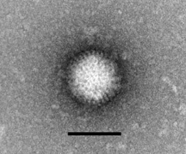 Rift Valley fever virus MP12 (Bunyavirus). Transmissions-Elektronenmikroskopie, Negativkontrastierung. Maßstab = 100 nm. Quelle: © RKI
