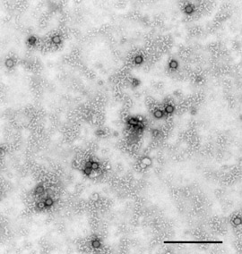 Rift Valley fever virus MP12 (Bunyavirus). Transmissions-Elektronenmikroskopie, Negativkontrastierung. Maßstab = 1 µm. Quelle: © RKI