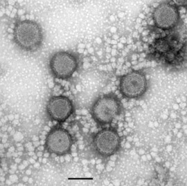 RVFV, Rift Valley fever virus MP12 (Bunyavirus). Transmissions-Elektronenmikroskopie, Negativkontrastierung. Maßstab = 100 nm. Quelle: © RKI