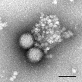 Rift Valley fever virus MP12 (Bunyavirus). Transmissions-Elektronenmikroskopie, Negativkontrastierung. Maßstab = 100 nm. Quelle: © RKI