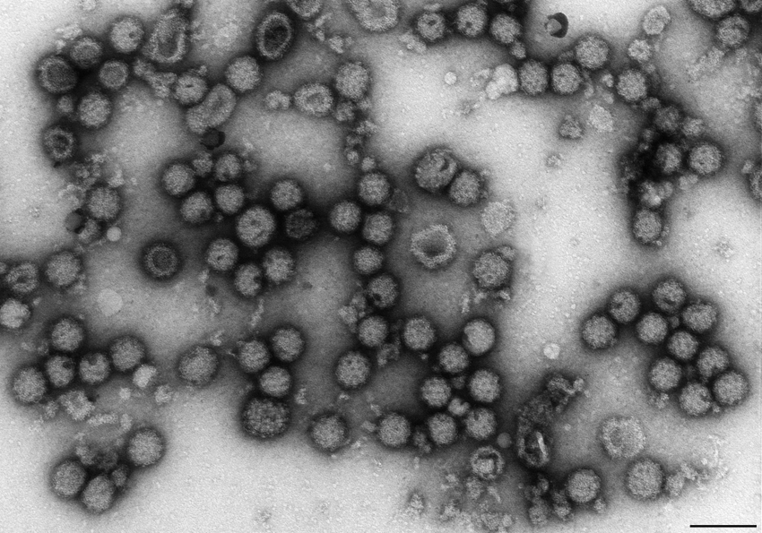 rubella virus picture #11