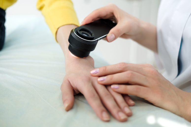 A healthcare professional uses a dermatoscope to examine the skin on the back of a person's hand to detect skin changes or signs of skin cancer. (© skvalval – stock.adobe.com) A healthcare professional uses a dermatoscope to examine the skin on the back of a person's hand to detect skin changes or signs of skin cancer.