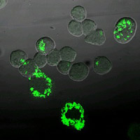 Konfokale Laser Scanning Fluoreszensmikroskopie. Quelle: © RKI