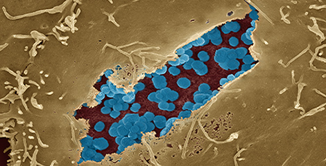 Chlamydien in aufgebrochenem Einschlusskörper einer Hela-Zelle. Quelle: © Hans R. Gelderblom; Kolorierung Andrea Schnartendorff/RKI