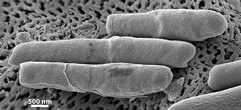 Clostridium difficile NCTC 13307; Elektronenmikroskopie; Bakterien; Bacteria; Firmicutes; Clostridia; Clostridiales; Clostridiaceae, Primärvergrößerung x 112370. Maßstab = 500 nm. Quelle: © Norbert Bannert; Lars Möller/RKI