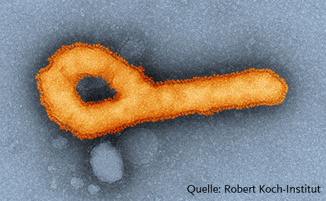 Elektronenmikroskopische Aufnahme von Ebolaviren (Orange eingefärbt). Quelle: © Tobias Hoffmann (2019)/RKI