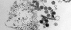 Cutout: West Nile virus. Flavivirus, Flaviviridae. Electron microscopy, ultrathin sectioning. Bar = 100 nm. Source: © Hans R. Gelderblom (2003)/RKI