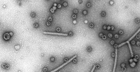 Hepatitis B Virus, HBV, Primärvergrößerung x 50000, gentechnisch erzeugte HBV-Cores. Quelle: © Muhsin Özel/RKI