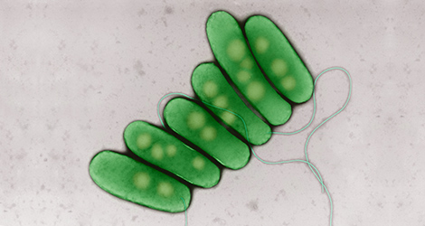 Legionella pneumophila Serogruppe 1 (koloriert). Transmissions-Elektronenmikroskopie, Negativkontrastierung. Maßstab = 1 µm. Quelle: © Hans R. Gelderblom, Rolf Reissbrodt/RKI