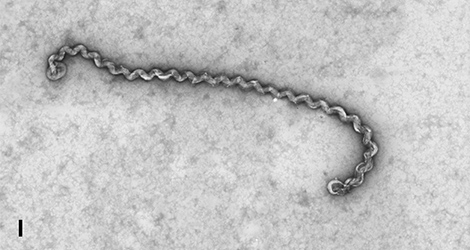 Leptospira. Negativ-Kontrastierung; Elektronenmikroskopie; TEM. Bar = 500 nm. (© RKI) Leptospira. Negativ-Kontrastierung; Elektronenmikroskopie; TEM. Bar = 500 nm.
