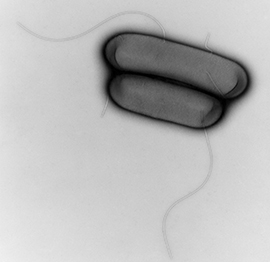 Listeria monocytogenes NCTC 7973, Primary magnification x 16000. Source: © Hans R. Gelderblom/RKI