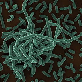 Listeria monocytogenes wildtype EGD. Scanning electron microscopy. Bar = 1 µm. Source: © Petra Kaiser (2013)/RKI