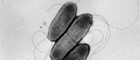 Cutout: Burkholderia pseudomallei, flagellated bacteria. Transmission electron microscopy, negative staining. Bar = 1 μm. Quelle: © RKI