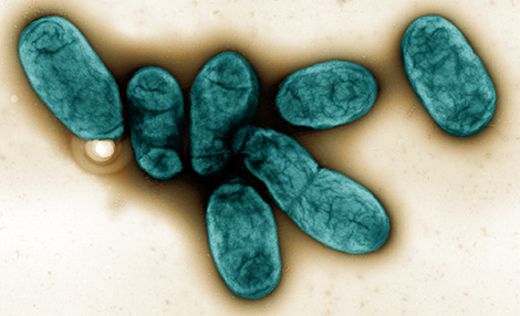 Yersinia pestis, Vergrößerung 8000–fach. Quelle: © RKI