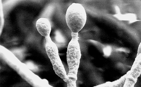 EM-Aufnahme. Hier ist der Schimmelpilz Scedosporium prolificans abgebildet. Quelle: © Muhsin Özel/RKI