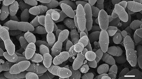 Streptococcus pneumoniae. Raster-Elektronenmikroskopie. Maßstab = 500 nm. Quelle: © Muhsin Özel, Gudrun Holland, Rolf Reissbrodt/RKI