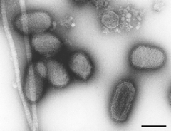 Parapoxviruses from a lesion of the human skin. Negative staining electron microscopy. Bar = 200 nm. (© RKI) Parapoxviruses from a lesion of the human skin. Negative staining electron microscopy. Bar = 200 nm.