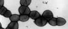 Bildausschnitt: Streptococcus pneumoniae (Pneumokokken). Transmissions-Elektronenmikroskopie, Negativkontrastierung. Maßstab = 1 µm. Quelle: Hans R. Gelderblom, Rolf Reissbrodt/RKI