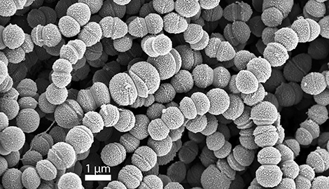 Streptococcus pyogenes, Primärvergrößerung x 20000, Columbia-Blutagar (5% Schafblut), 36+/-1°C, 24 Std., kapnophil (5-7% CO2). u.a. Auslöser von Scharlach, Angina lacunaris, Kindbettfieber etc. Quelle: © M. Özel, R. Reissbrodt, G. Holland/RKI
