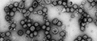 Bildausschnitt: Semliki Forest virus (Alphaviren). Transmissions-Elektronenmikroskopie, Negativkontrastierung. Maßstab = 200 nm. Quelle: RKI