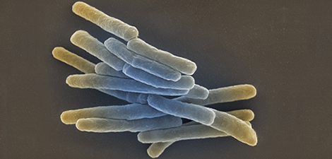 Mycobacterium tuberculosis. (© RKI) Mycobacterium tuberculosis.