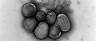 Bildausschnitt: Francisella tularensis, Bakteriengruppe. Transmissions-Elektronenmikroskopie, Negativkontrastierung. Maßstab = 1 μm. Quelle: RKI